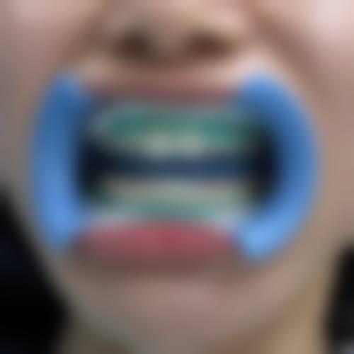 三亚圣赫口腔门诊部患者真实评价