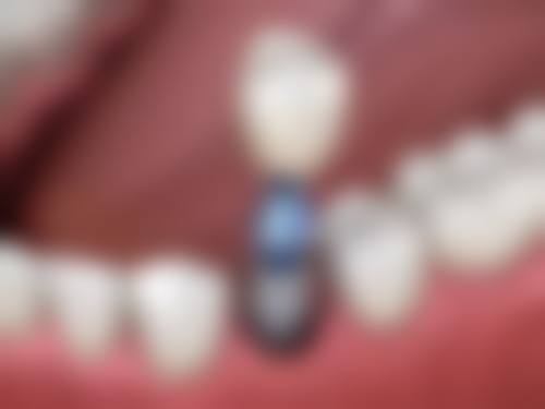 诸城志远口腔来院指引