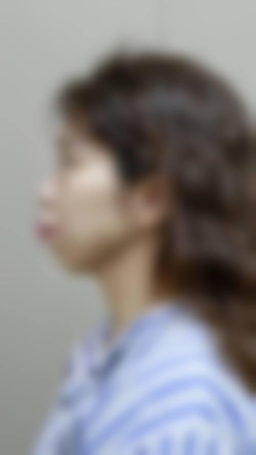 山东济南历下博瑞特口腔患者真实评价