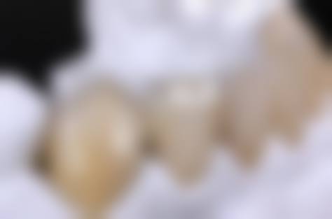 贵阳心博雅口腔诊所来院指引