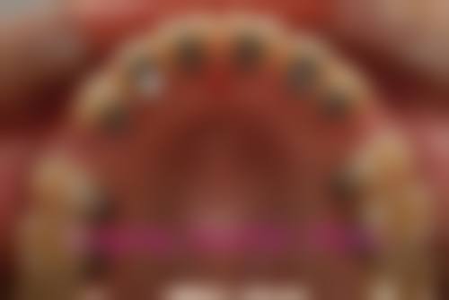 安徽滁州凤阳县爱牙乐口腔正规资质