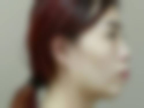 兴仁鑫侬口腔诊所特色技术项目