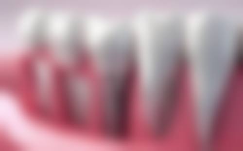 张家口师磊口腔诊所收费标准参考