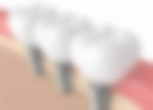 成都锦江极光口腔医院患者真实评价