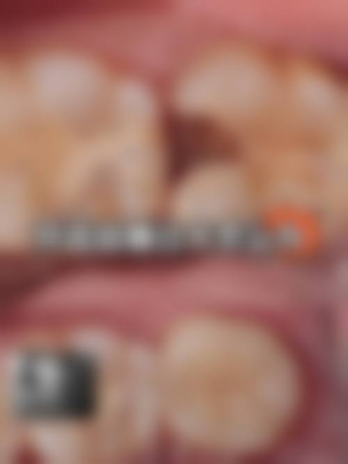 巴中巴州医附大口腔门诊部口碑怎么样