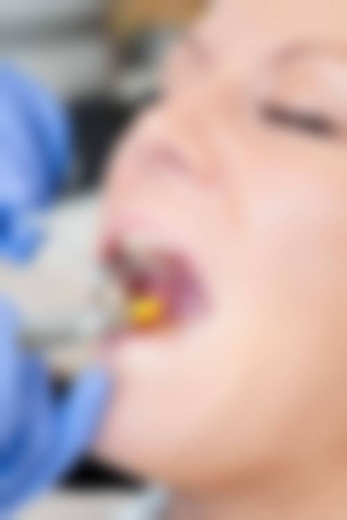 为什么要选择江苏苏州润芽口腔?