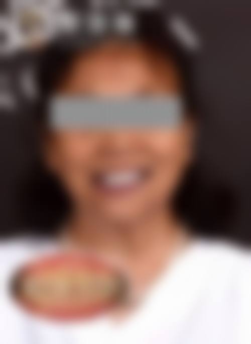 溧阳瀚雅口腔口碑怎么样