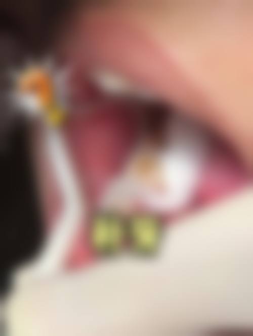 甘肃酒泉黄文平口腔诊所收费价格表