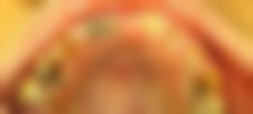 浙江温州平阳茗芽口腔特色项目及技术优势