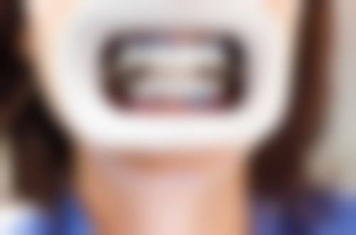 浙江慈溪雅卫仕口腔交通路线攻略