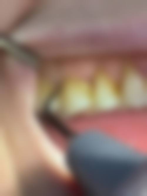 浙江嘉兴海宁许张洪口腔诊所是正规的吗/怎么样/靠谱吗