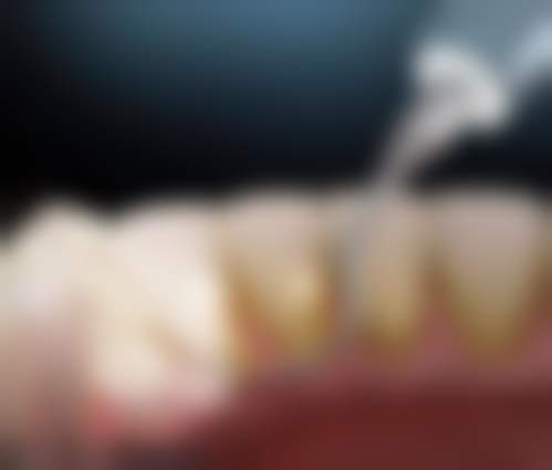 重庆康悦美鸿雲口腔(锦虹店)口碑怎么样